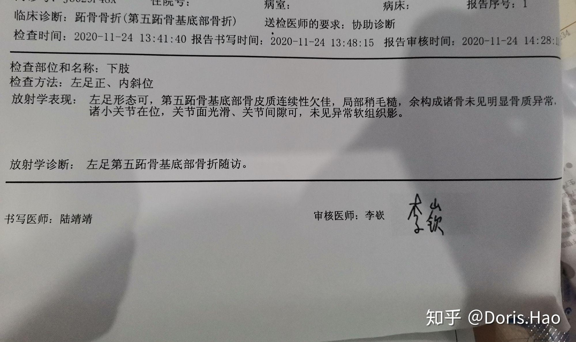 第五跖骨基底部骨折恢复过程