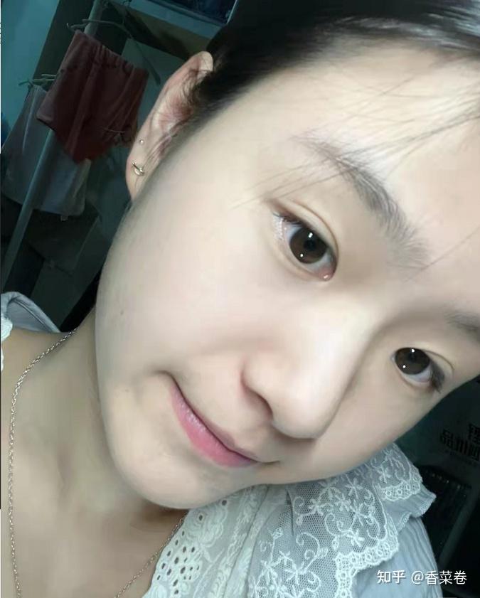 女生如何养好皮肤?