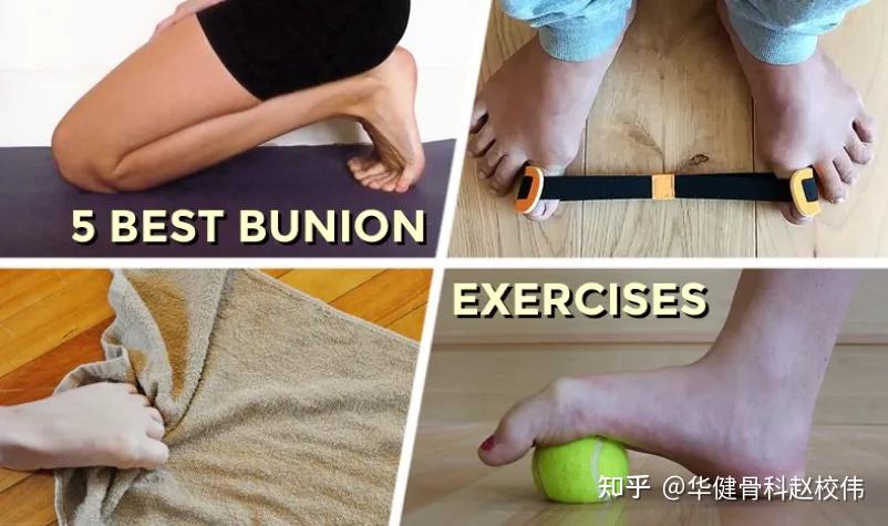 郏县华健骨科医院拇囊炎疼痛的原因和治疗方法