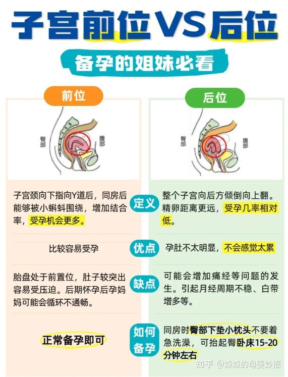 子宫前位VS后位 备孕哪个更容易 - 知乎