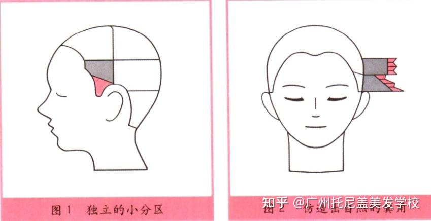 最出名的美髮學校是哪個沒有鬢角怎麼辦頭部左右不對稱如何進行修復