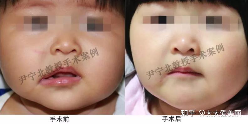 人气整形医生合集2:尹宁北章庆国李发成靳小雷穆大力测评-含唇