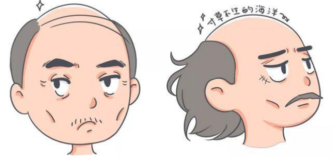 想在临沂植发植发的医生怎么选怎么判断自己到底适不适合植发