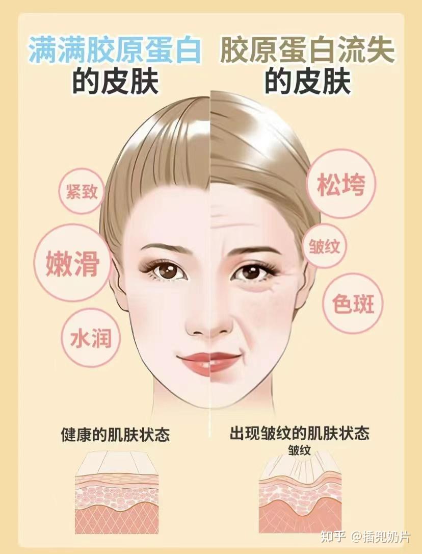 脸塌,脸垮,长皱纹,流失的胶原蛋白可以通过口服胶原蛋白补回来吗? - 知乎