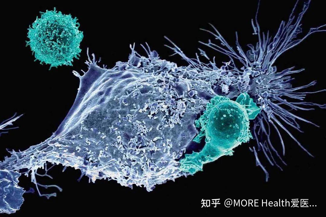 中国首款cart疗法获批该疗法的新篇章竟是7岁女孩emily开启的