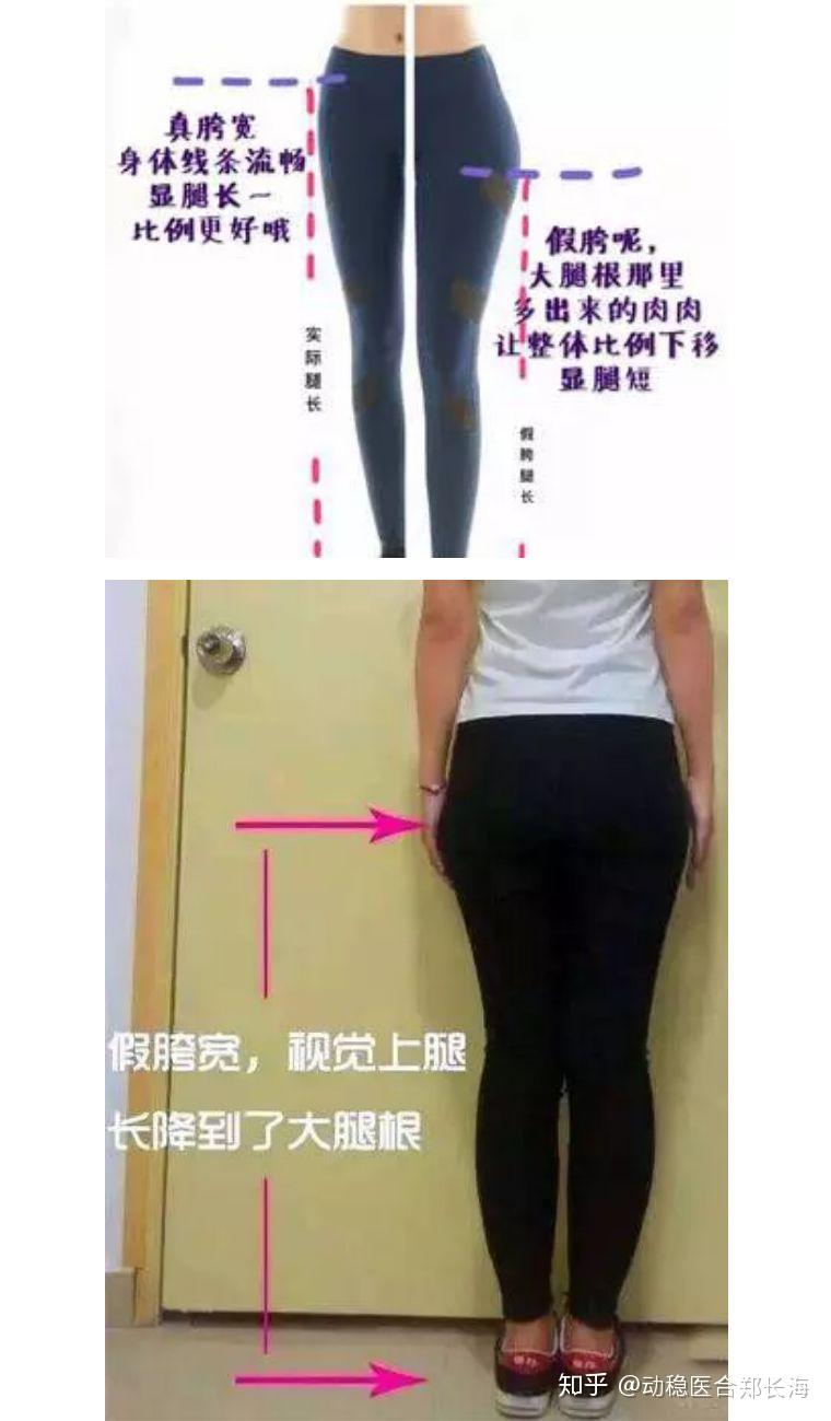 一个动作改善假髋内附视频
