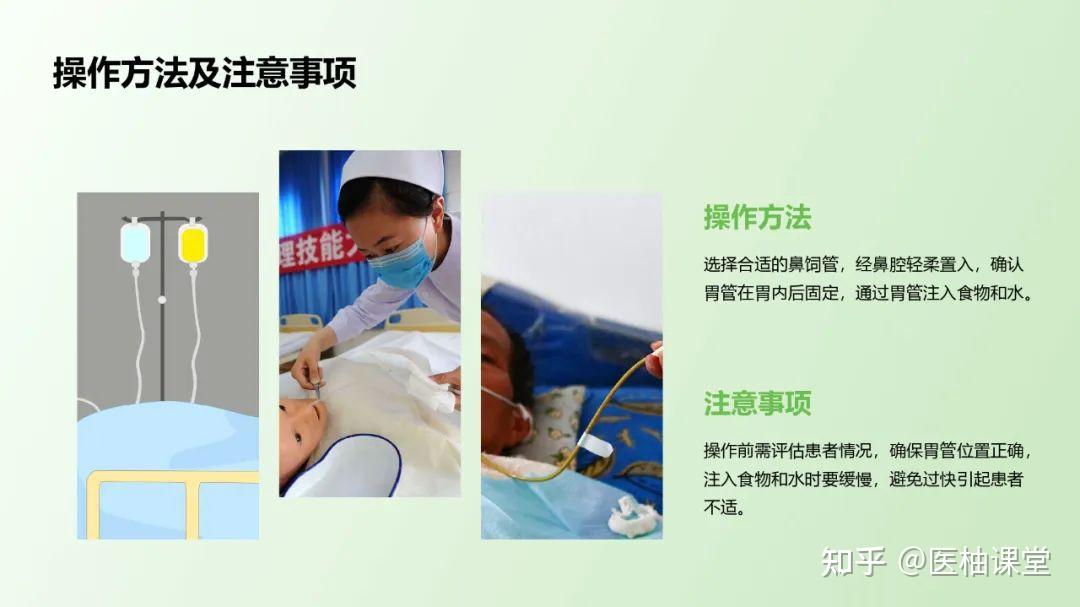 鼻饲患者并发症的预防与维护 - 知乎