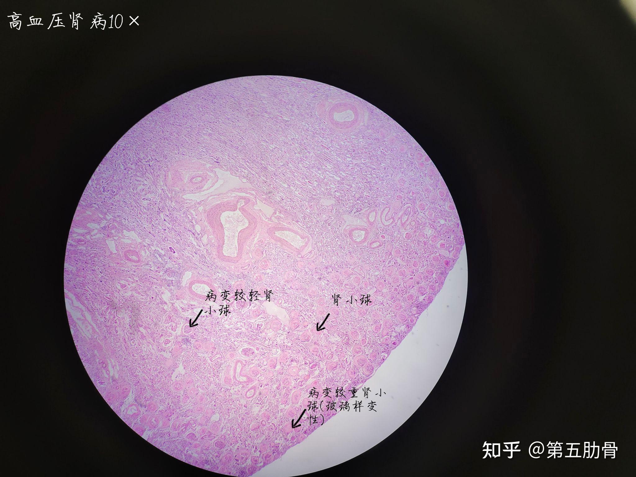 脾组织切片图解图片