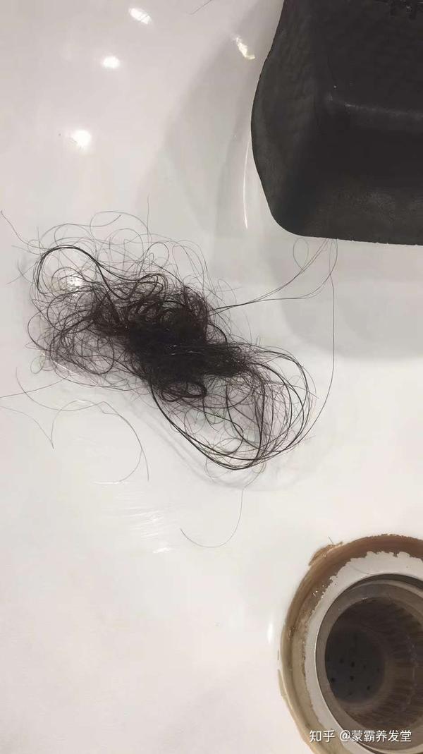女的掉头发厉害的原因