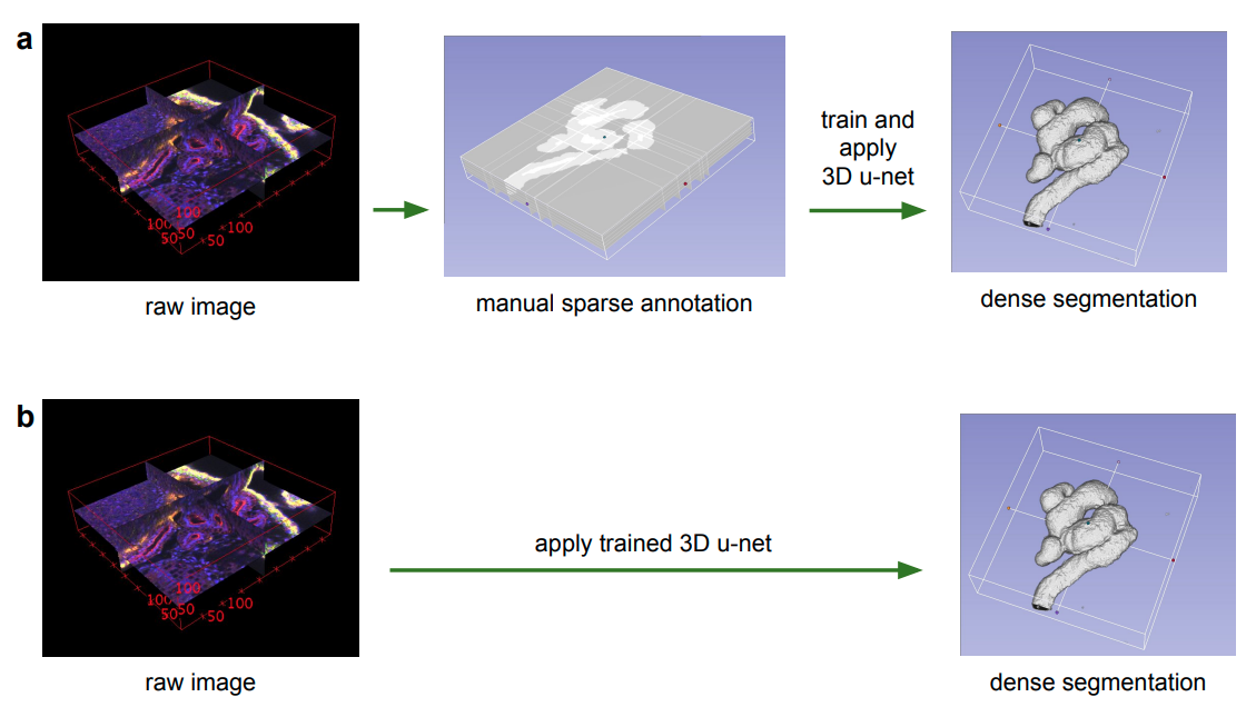 [CV - 3D图像分割 ]生物医学立体图像分割3D U-Net模型 - 知乎