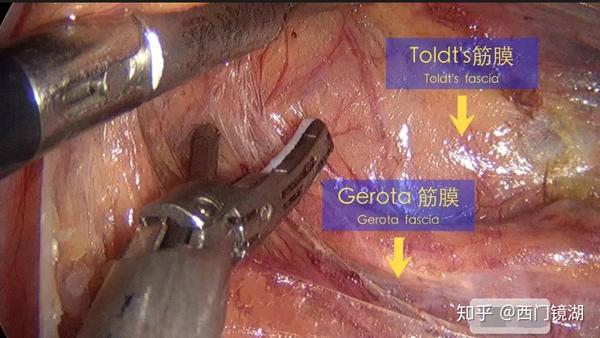 拉伸啊拉伸什么是筋膜