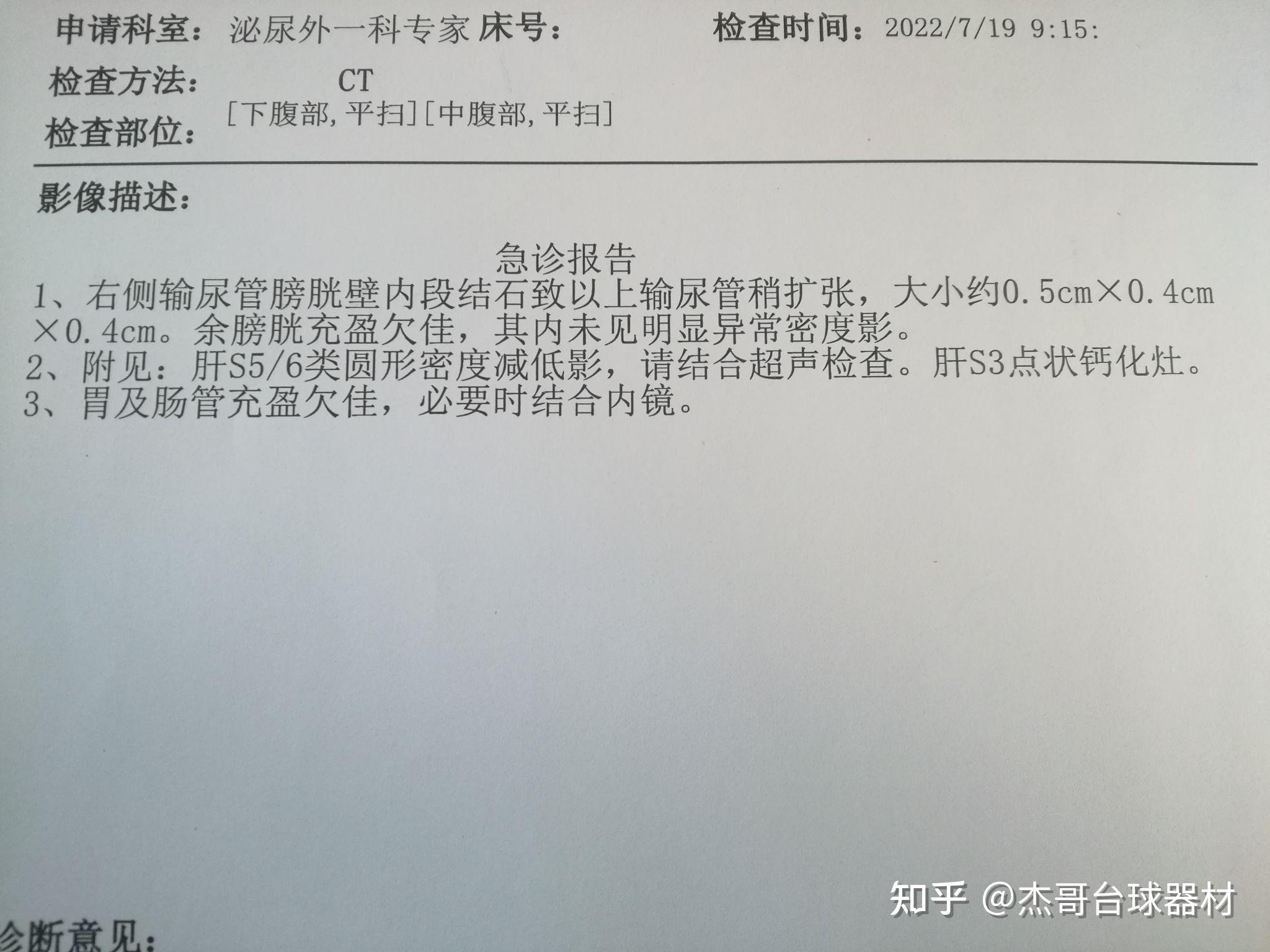 肾结石CT报告图片