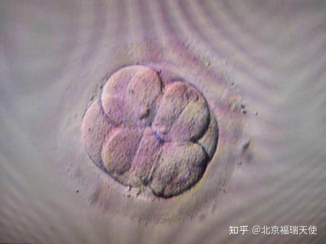 胚胎移植1、2、3 - 知乎