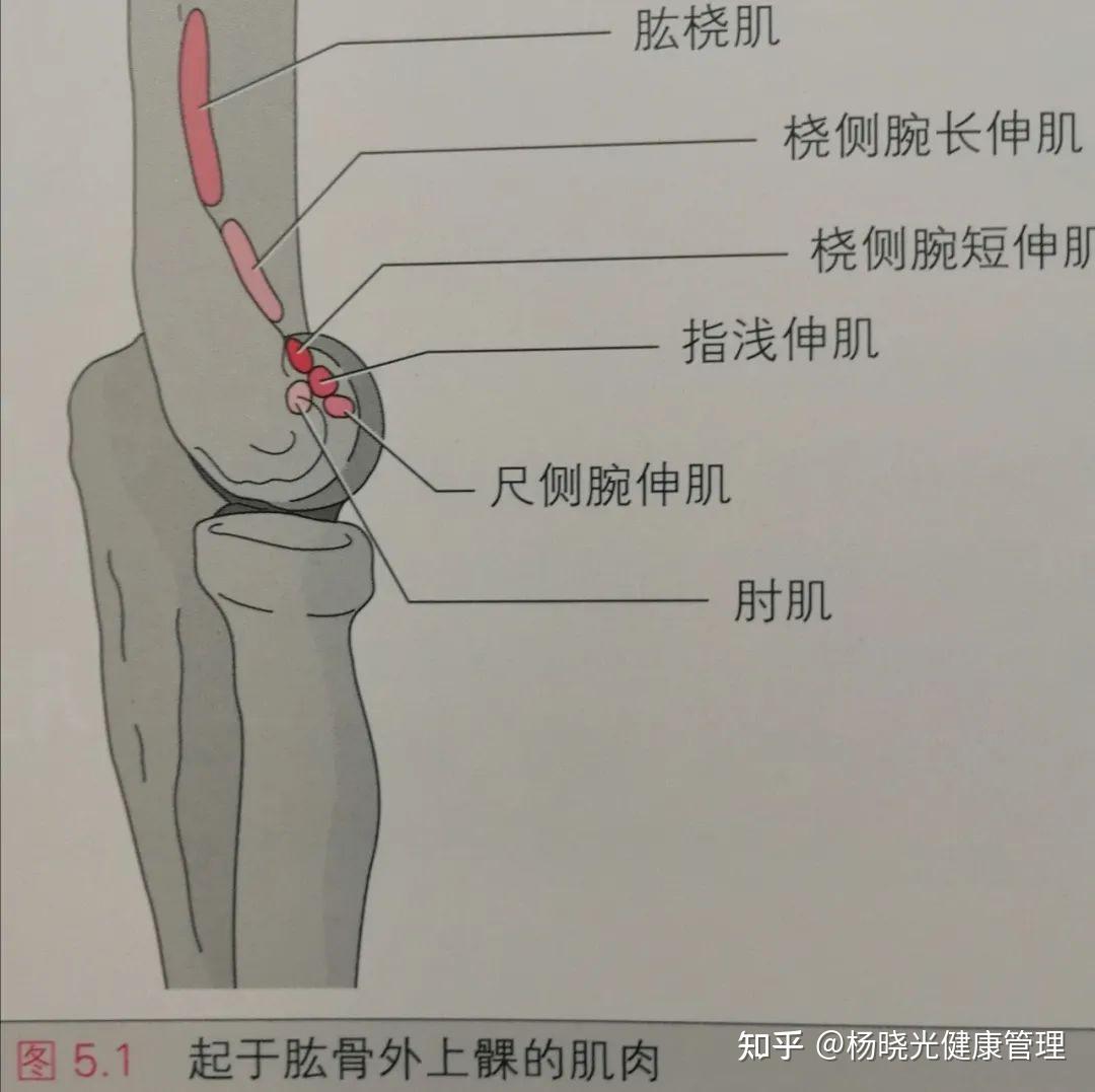 当我们玩手机,提重物或者拧毛巾时经常会感觉到肘关节外侧部位疼痛,这