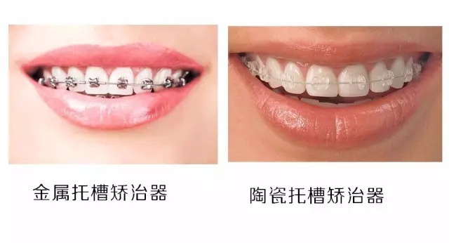 怎么才能让牙齿变得松散 v2-251317ccfc40c0e3769d705aba2d70d5_1440w.jpg?source=172ae18b