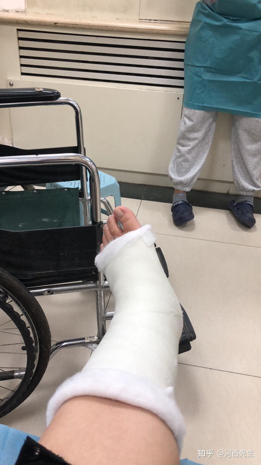 故事问工作调动我意防骨折不信半月后走路崴脚居然骨折了