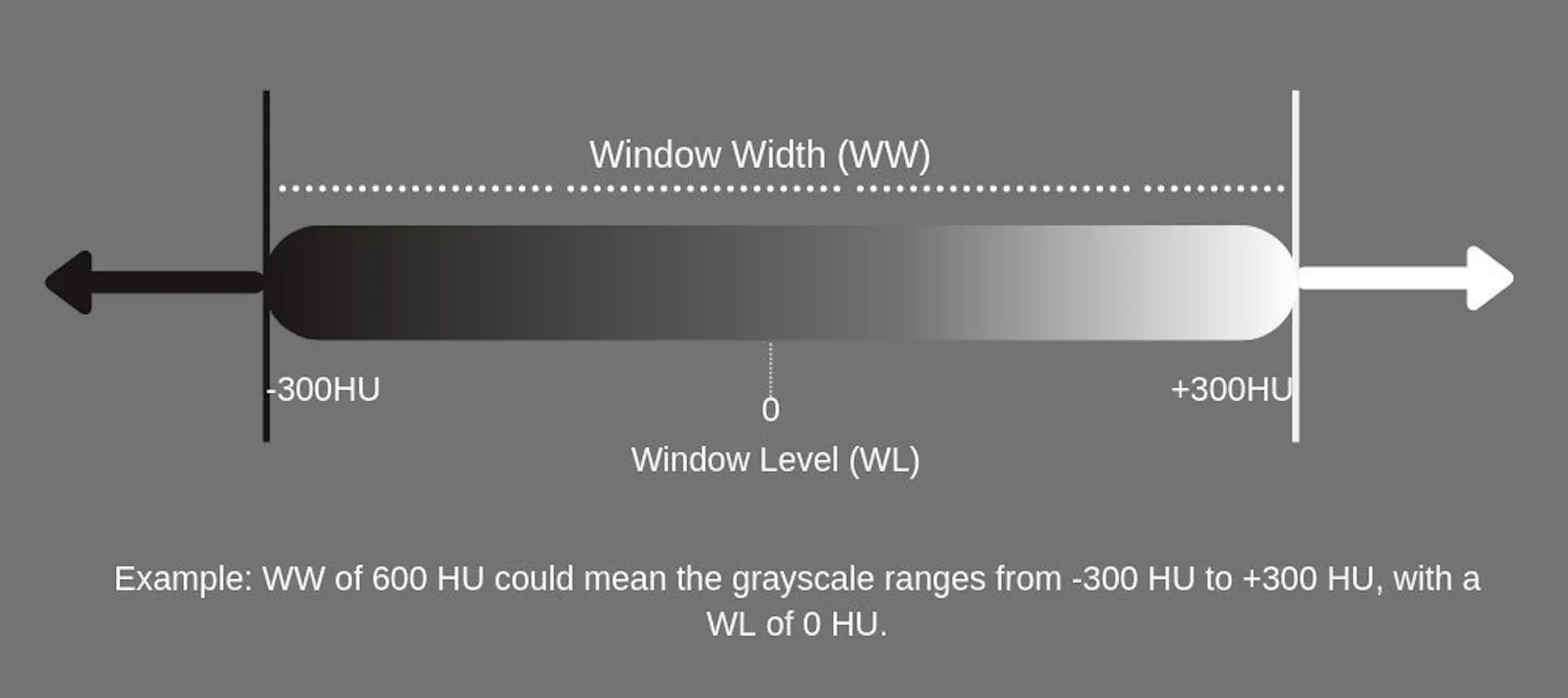 Window Ct Cs CT-Windowing医学CT图像增强 - 知乎