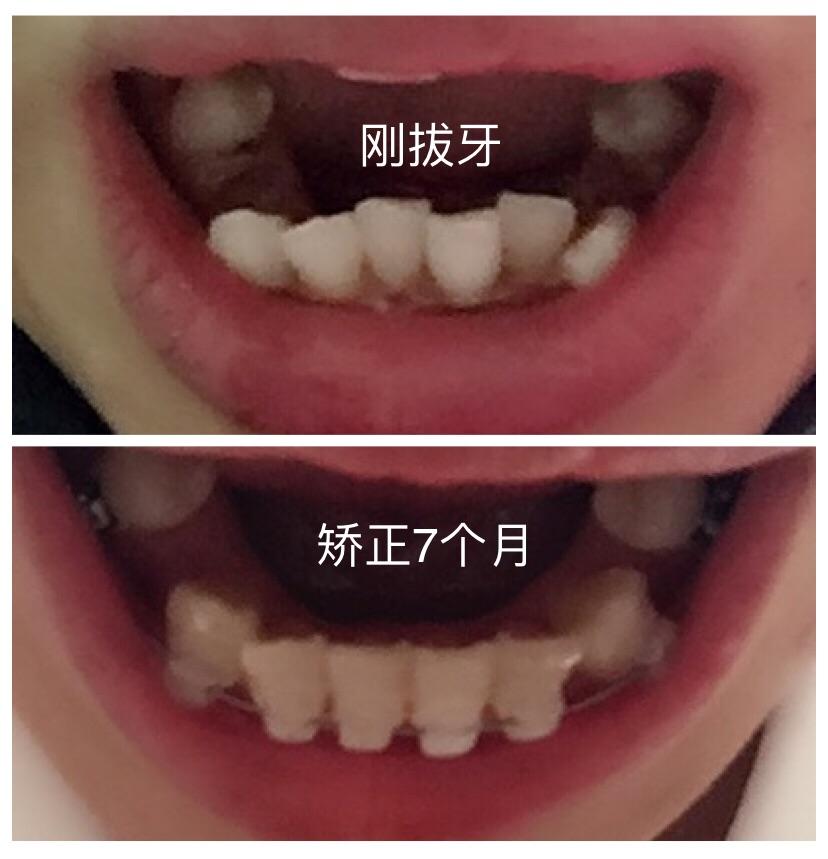 v2-255d5c14c271e0e400e5e7a5dd28fcb2_r.jpg