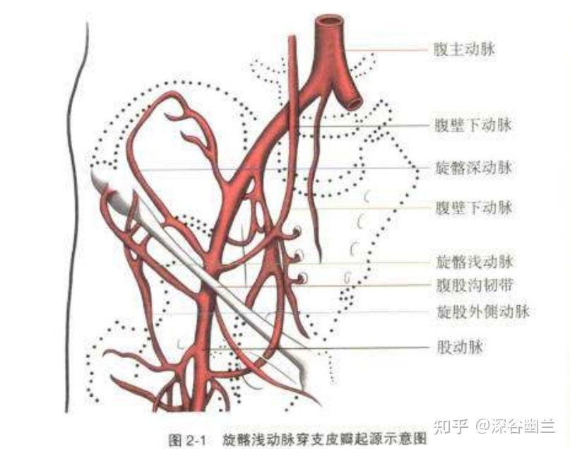 髂筋膜阻滞旋髂深动脉图片