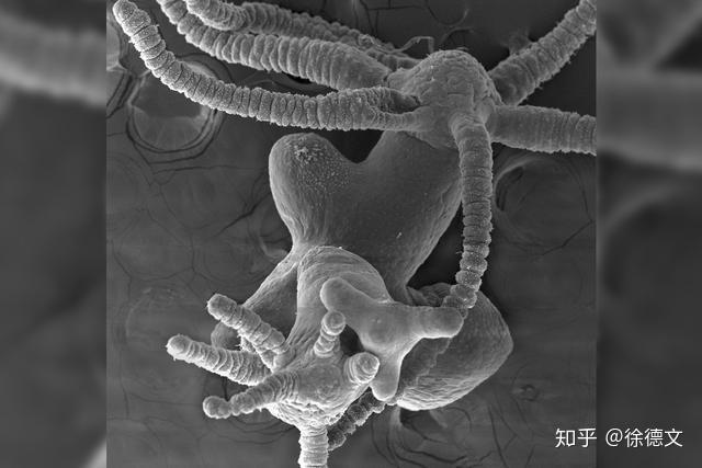 这种动物有9个脑袋删掉1个基因就会长成浑身脑袋的恐怖异形