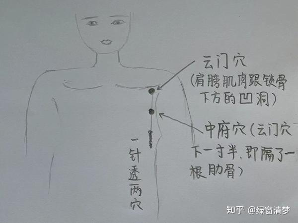 倪海厦针灸课笔记(10)— 手太阴肺经诸穴 - 知乎