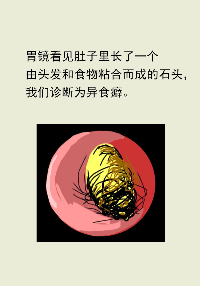 小女孩儿爱吃头发,专家称是异食癖:从小太缺母爱