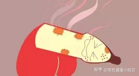 【株洲九龙课堂】包皮垢好烦人,怎么处理好? - 知乎