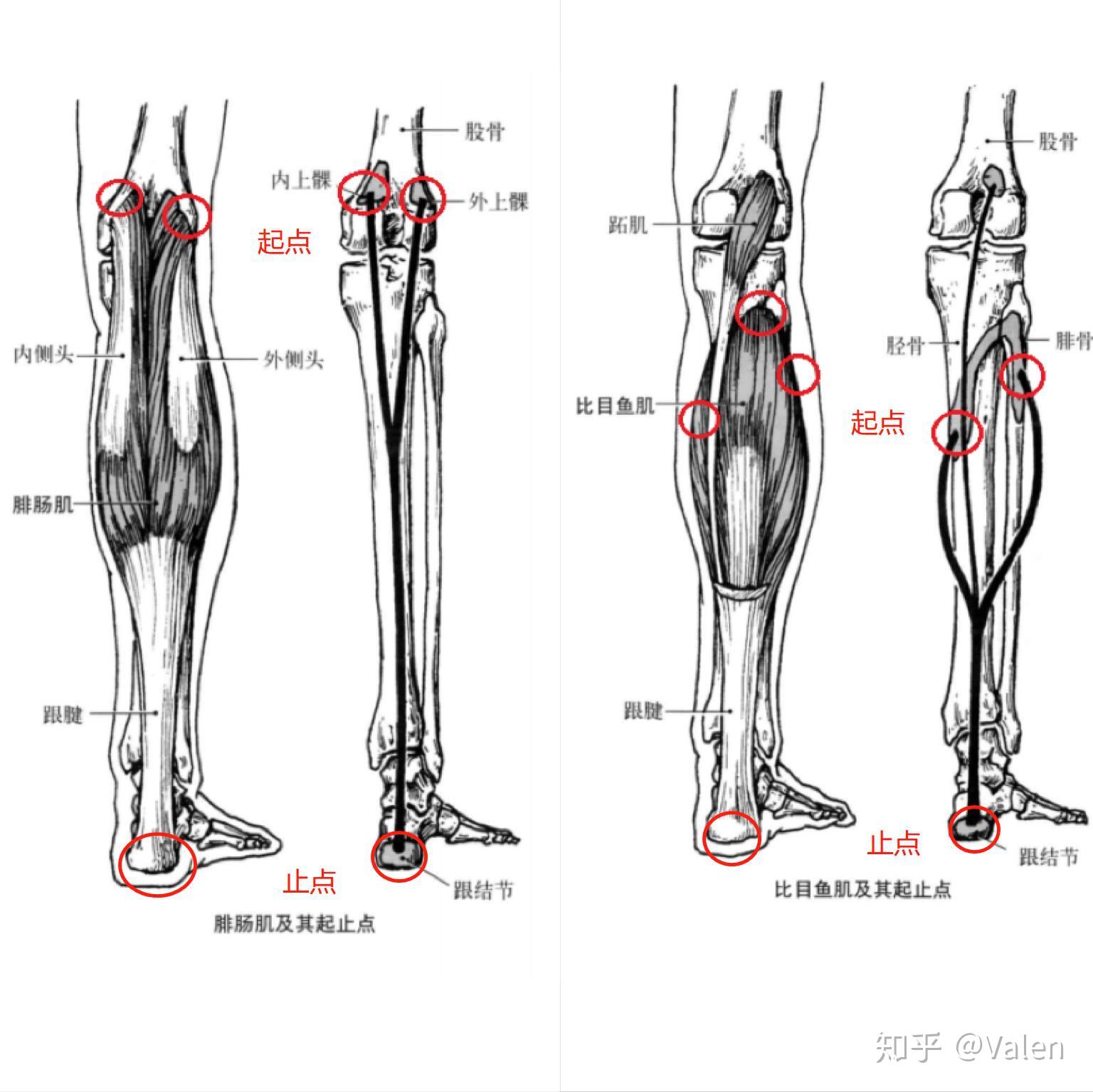 【腿型分析】教你判断O型腿、X型腿、和XO型腿的区别 - 知乎