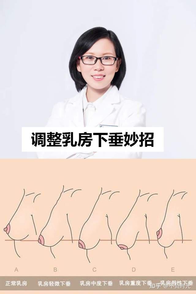 产后乳房变得干瘪下垂,失去活力和弹性,让女性的魅力瞬间变成负分,别