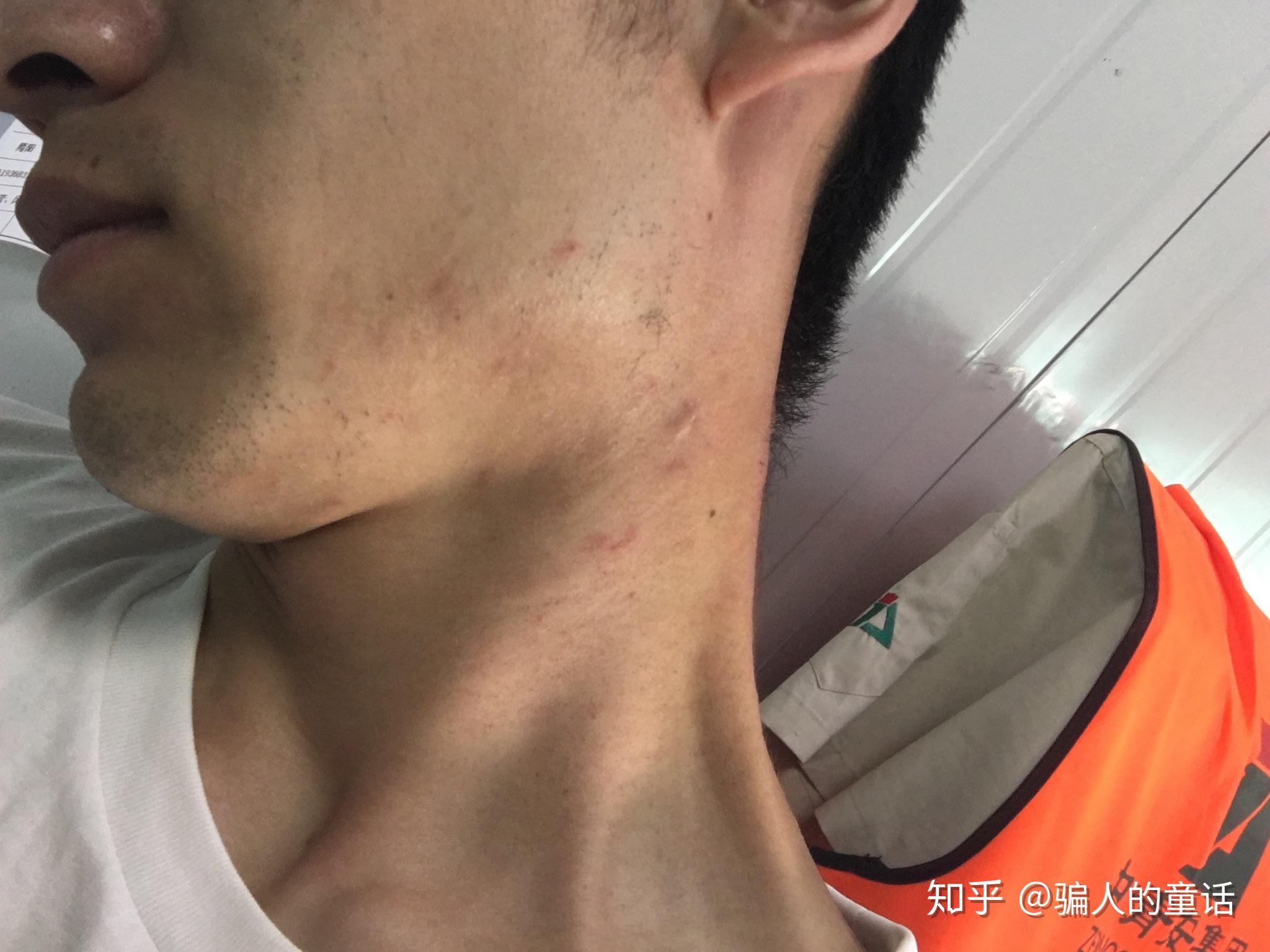 腮边痘 zhuanlan.zhihu.com