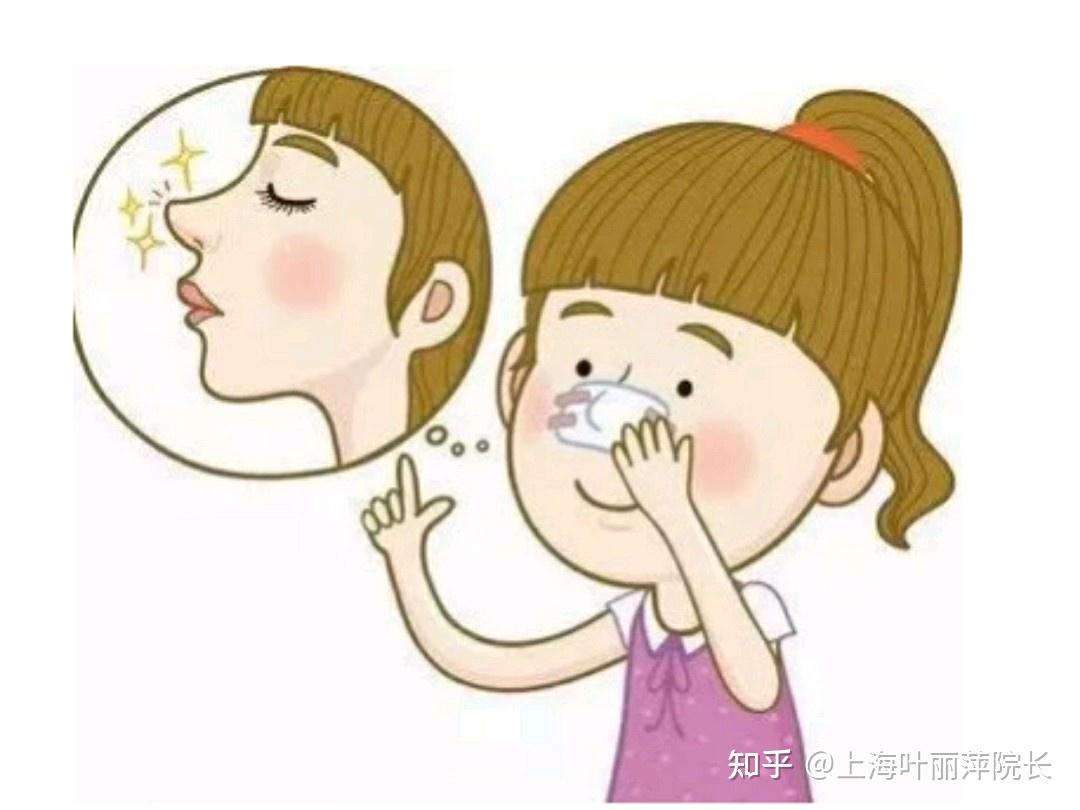 上海九院隆鼻哪个医生能做出妈生鼻？假体隆鼻&自软骨隆鼻 - 知乎