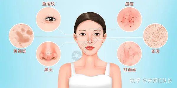 这些脸上反映的妇科病信号,你知道吗 ?