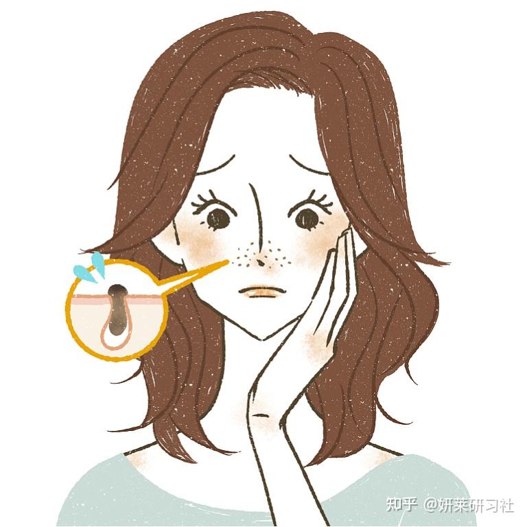 黑头越祛越多你有这些坏习惯吗