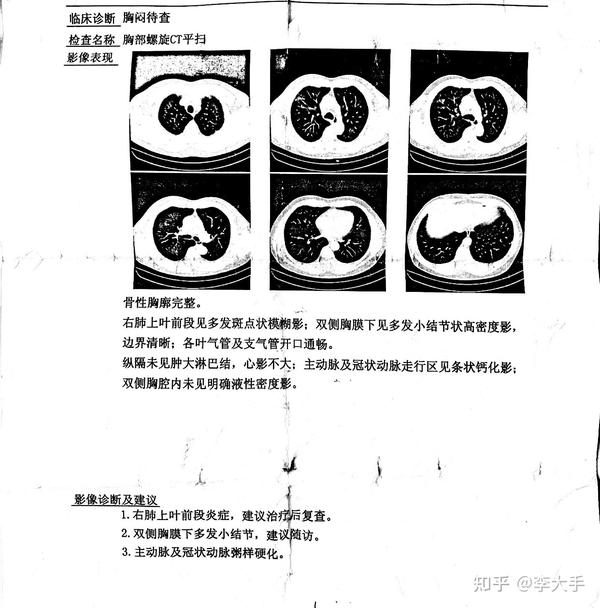 求助总是夜咳怎么办？ 知乎 