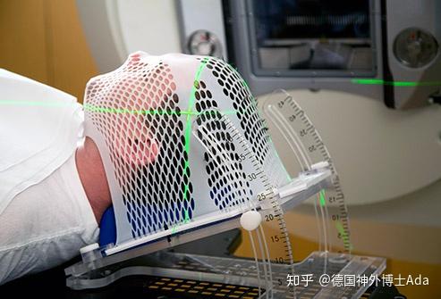 高级别胶质瘤术后放疗可以取得显著的生存获益(1级证据).