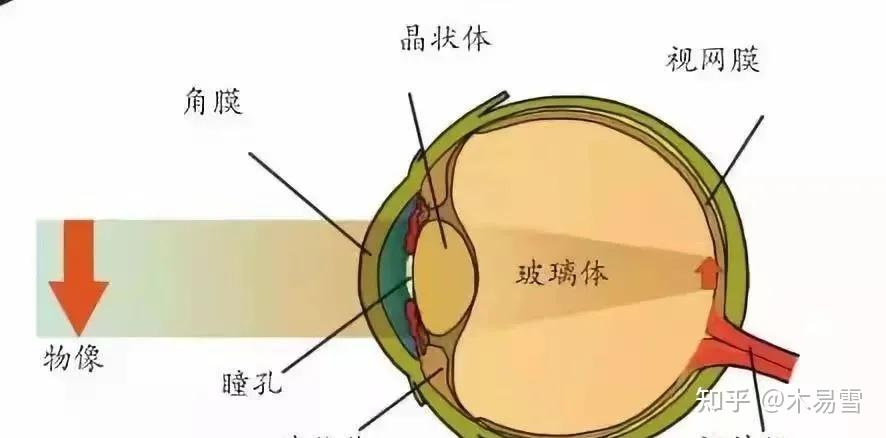 通俗理解裸眼视力和屈光度的关系