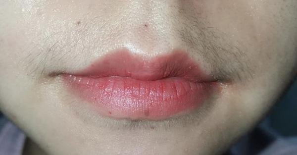 女生的唇毛(小胡子)能刮吗?