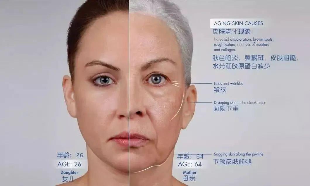 什么是糖化 如何减少ages的产生 知乎