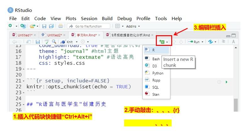 Rmarkdown学习-code chunk程序代码块 - 知乎