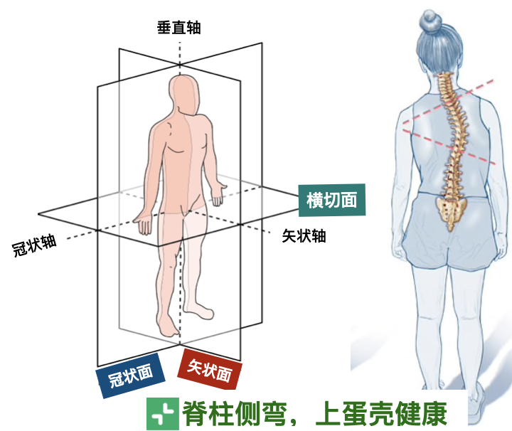 如何運動康復糾正脊柱側彎