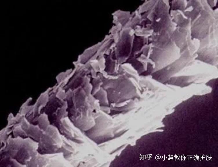 脱发、头发干燥，不想成为秃子怎么办？看这里…… 知乎