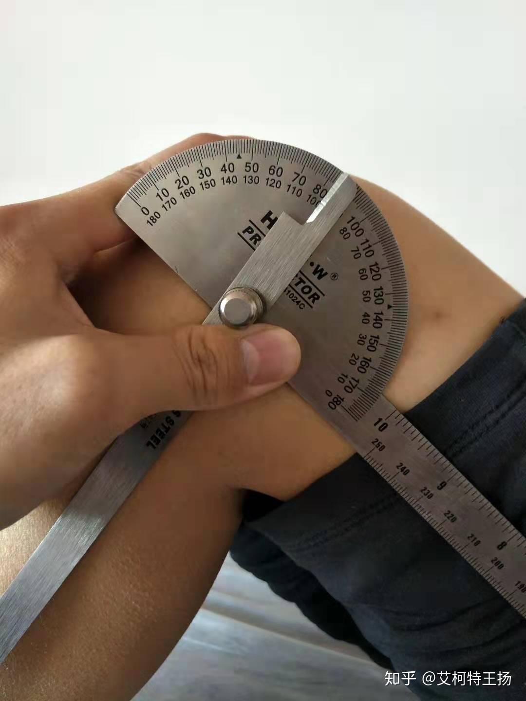 膝关节屈曲角度98度膝关节屈曲角度100度4,因为股四头肌萎缩的比较