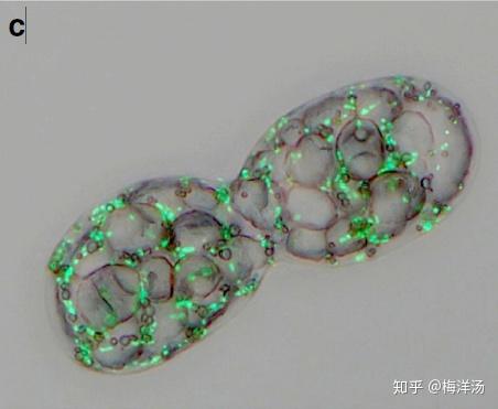 “重度结石细菌”——小石子细菌Achromatium(2)