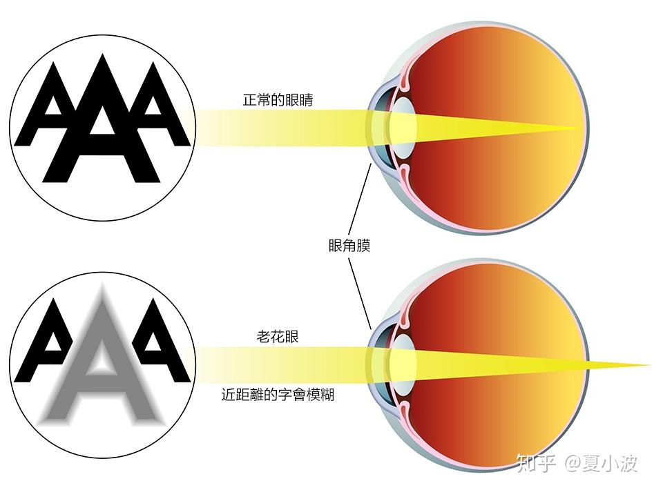 一文说清楚老花眼 / 品牌老花眼镜推荐—老花镜有度数吗?