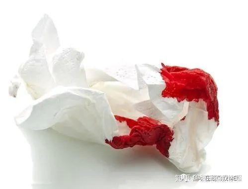 周公解梦,梦见纸上面好多血,意味着什么? 周公解梦,梦见纸上面好多血,意味着什么?