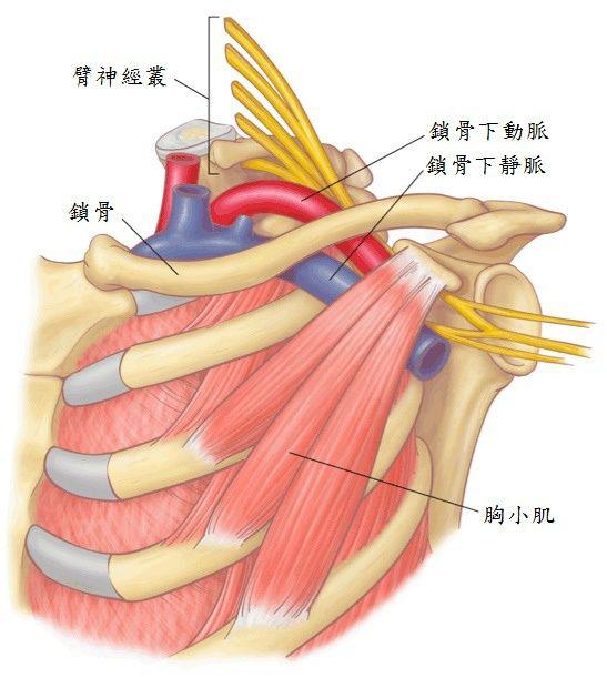 疾病三:胸廓出口综合征