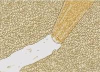 划痕实验浅谈 - 知乎