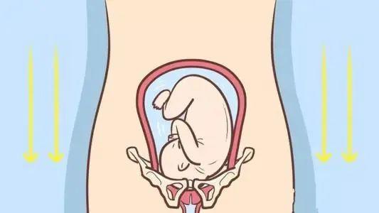 胎儿胎头位于耻骨上图图片