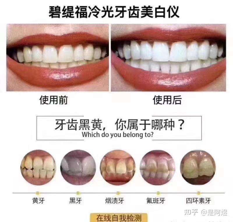 因为07黄女朋友跟我分手了