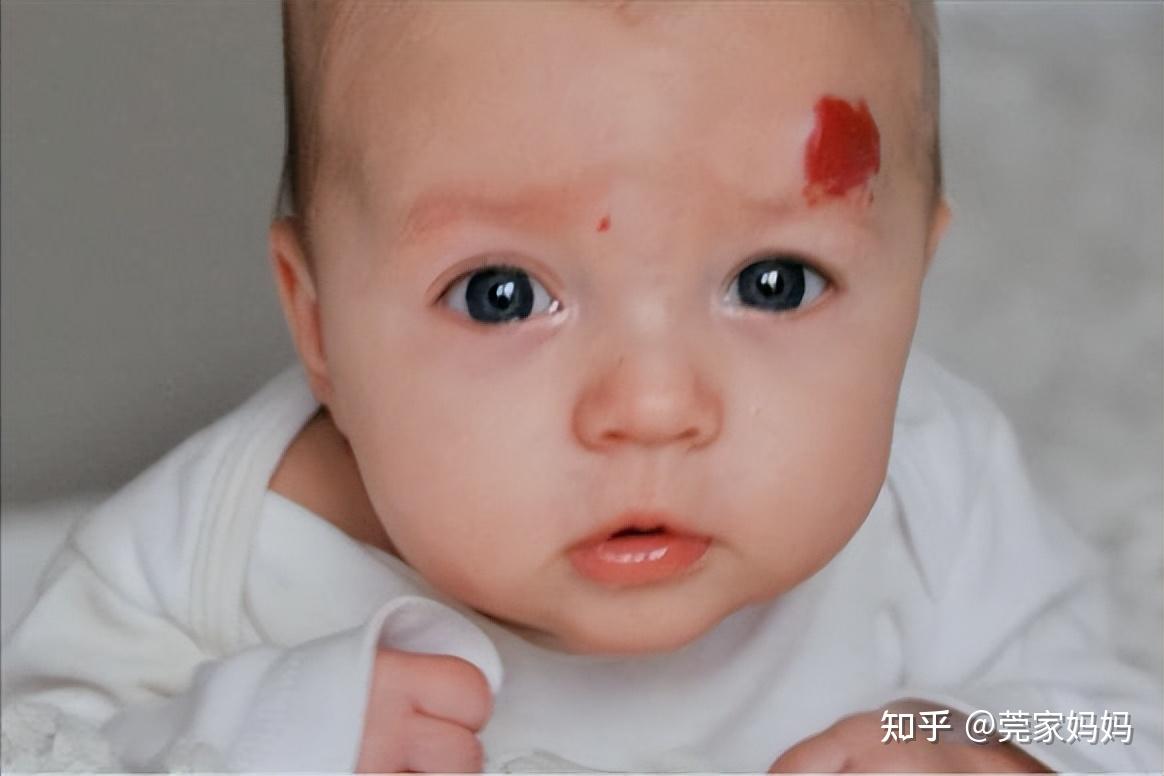 刚出生的婴儿脸上有红色胎记（新生儿长有这3种红色胎记）-幼儿百科-魔术铺